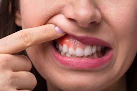 gum treatment in Vasant Kunj